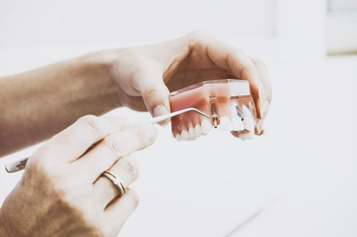 Glasgow dentist holding false teeth and placing an implant into the gum with a dental tool